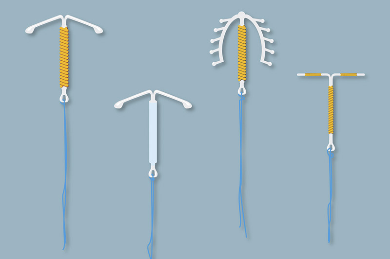 saiba tudo sobre inserção de diu 